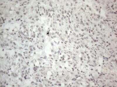 Immunohistochemistry: HIST1H2BA Antibody (OTI1C9) [NBP2-45974]