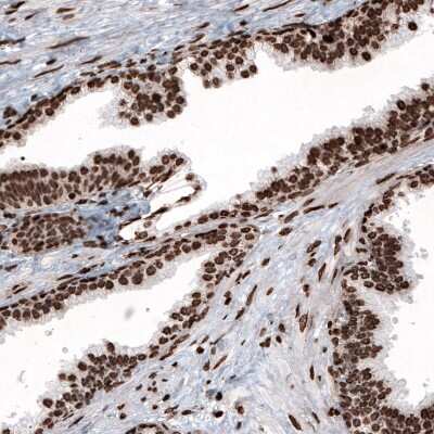 Immunohistochemistry: HIST1H2BC Antibody (CL5048) [NBP2-61153]
