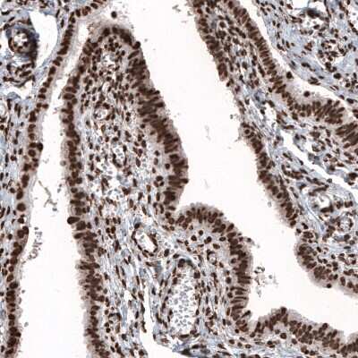 Immunohistochemistry: HIST1H2BC Antibody (CL5048) [NBP2-61153]