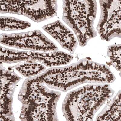 Immunohistochemistry: HIST1H2BC Antibody (CL5048) [NBP2-61153]