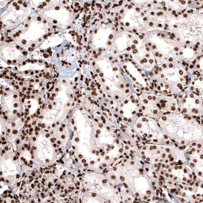 Immunohistochemistry: HIST1H2BC Antibody (CL5048) [NBP2-61153]