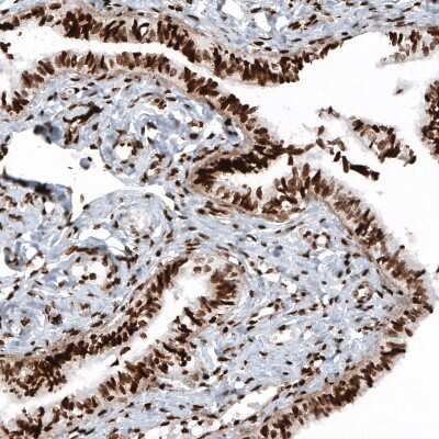 Immunohistochemistry: HIST1H2BC Antibody (CL5101) [NBP2-61154]