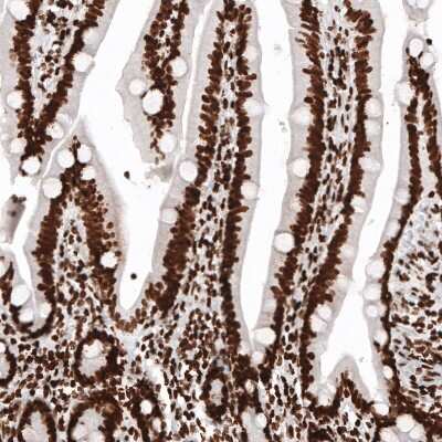 Immunohistochemistry: HIST1H2BC Antibody (CL5101) [NBP2-61154]