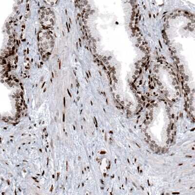 Immunohistochemistry: HIST1H2BC Antibody (CL5101) [NBP2-61154]