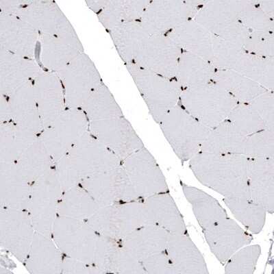 Immunohistochemistry: HIST1H2BC Antibody (CL5101) [NBP2-61154]