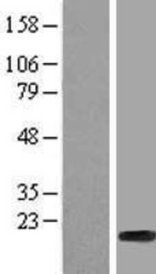 Western Blot: HIST1H2BF Overexpression Lysate [NBP2-07988]