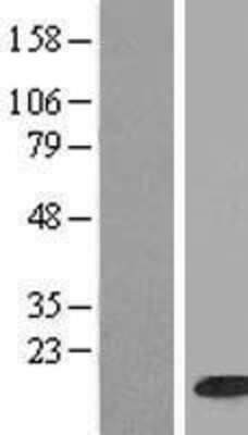 Western Blot: HIST1H2BH Overexpression Lysate [NBP2-07989]