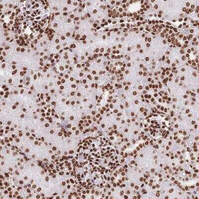 Immunohistochemistry: HIST1H2BD Antibody [NBP2-46672]