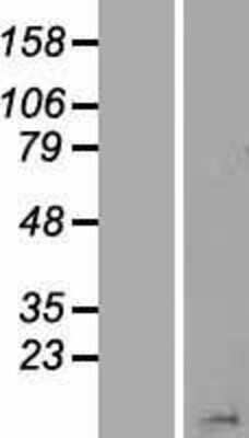 Western Blot: HIST1H2BN Overexpression Lysate [NBP2-07986]