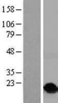 Western Blot: HIST1H2BO Overexpression Lysate [NBP2-07991]