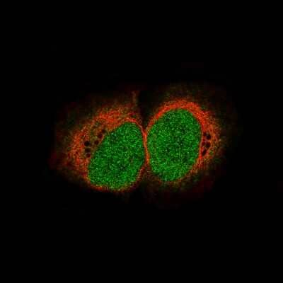 Immunocytochemistry/ Immunofluorescence: HIST1H3A Antibody (CL4967) [NBP2-61150]
