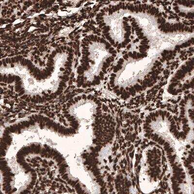 Immunohistochemistry-Paraffin: HIST1H3A Antibody (CL4967) [NBP2-61150]