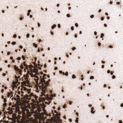 Immunohistochemistry-Paraffin: HIST1H3A Antibody (CL4967) [NBP2-61150]