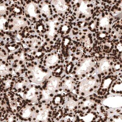 Immunohistochemistry-Paraffin: HIST1H3A Antibody (CL4967) [NBP2-61150]