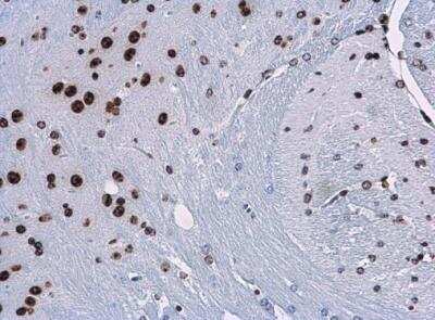 Immunohistochemistry-Paraffin: HIST1H3A Antibody [NBP2-16841]