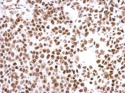 Immunohistochemistry-Paraffin: HIST1H3A Antibody [NBP2-16842]