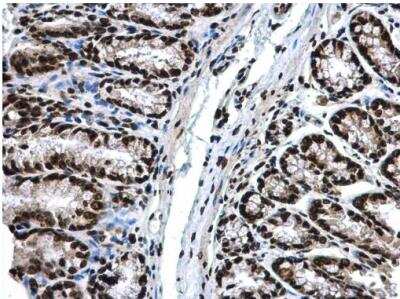 Immunohistochemistry-Paraffin: HIST1H3A Antibody [NBP2-16842]