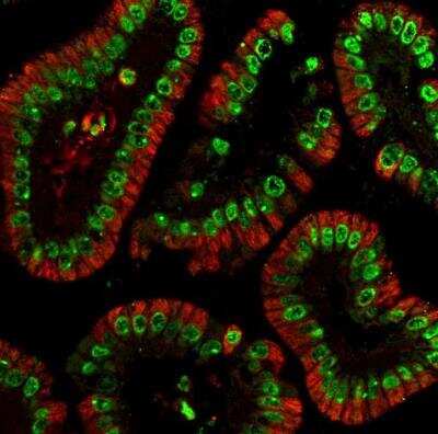 Immunohistochemistry-Paraffin: HIST1H3A Antibody [NBP2-16842]