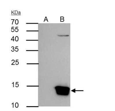 Immunoprecipitation: HIST1H3A Antibody [NBP2-16842]