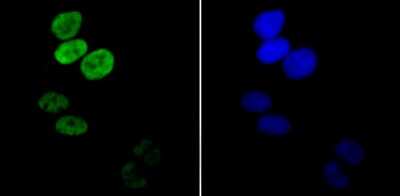 Immunocytochemistry/ Immunofluorescence: HIST1H3A Antibody (JU43-26) [NBP2-75522]