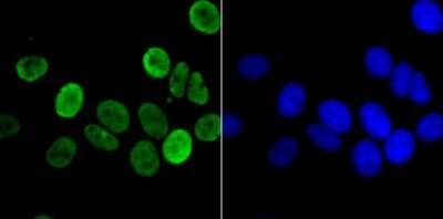 Immunocytochemistry/ Immunofluorescence: HIST1H3A Antibody (JU43-26) [NBP2-75522]