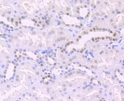 Immunohistochemistry-Paraffin: HIST1H3A Antibody (JU43-26) [NBP2-75522]