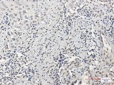 Immunohistochemistry-Paraffin: HIST1H3A Antibody (S06-4I8) [NBP3-14941]