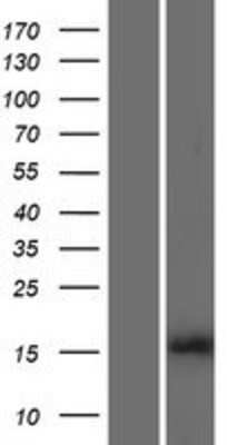 Western Blot: HIST1H3B Overexpression Lysate [NBP2-07995]