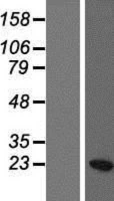 Western Blot: HIST1H3C Overexpression Lysate [NBP2-07993]