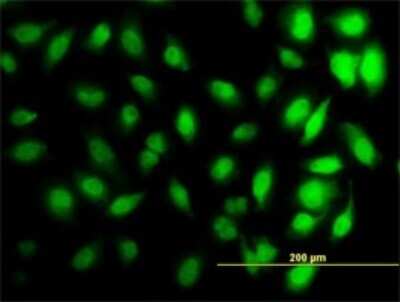 Immunocytochemistry/ Immunofluorescence: HIST1H3D Antibody (1D8) [H00008351-M01]