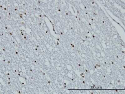 Immunohistochemistry-Paraffin: HIST1H3D Antibody (1D8) [H00008351-M01]