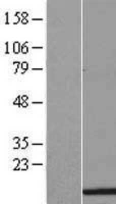 Western Blot: HIST1H3H Overexpression Lysate [NBL1-11566]