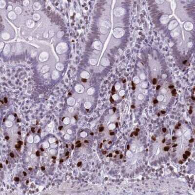 Immunohistochemistry-Paraffin: HIST1H4B Antibody [NBP2-54695]