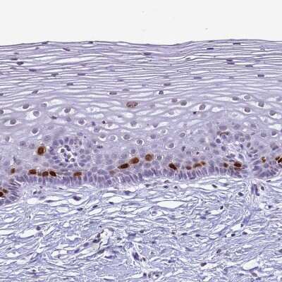Immunohistochemistry-Paraffin: HIST1H4B Antibody [NBP2-54695]