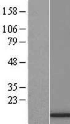 Western Blot: HIST1H4F Overexpression Lysate [NBP2-07996]