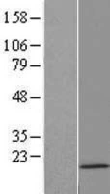 Western Blot: HIST2H3C Overexpression Lysate [NBP2-06572]