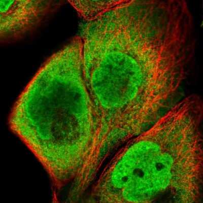 Immunocytochemistry/ Immunofluorescence: HIST1H2BC Antibody [NBP2-31878]