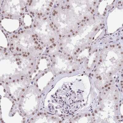 Immunohistochemistry: HIST1H2BC Antibody [NBP2-31878]