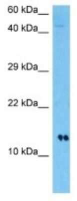 Western Blot: HIST3H2BB Antibody [NBP3-10185]