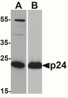 Western Blot: HIV-1 Gag p24 Antibody (7F4)BSA Free [NBP2-41339]