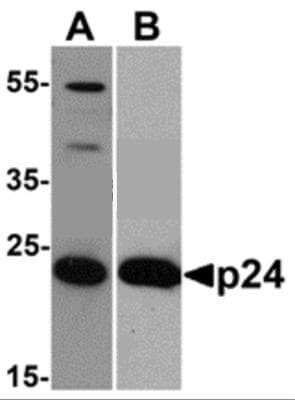 Western Blot: HIV-1 Gag p24 Antibody (8G9)BSA Free [NBP2-41336]