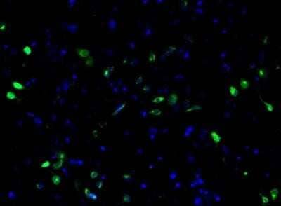 Immunocytochemistry/ Immunofluorescence: HIV-1 Gag p24 Antibody (ND1) - BSA Free [NB500-473]