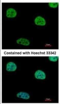 Immunocytochemistry/ Immunofluorescence: HIV-1 Rev binding protein Antibody [NBP2-16849]
