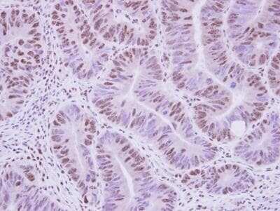 Immunohistochemistry-Paraffin: HIV-1 Rev binding protein Antibody [NBP2-16849]