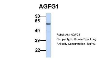Western Blot: HIV-1 Rev binding protein Antibody [NBP1-57277]