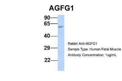 Western Blot: HIV-1 Rev binding protein Antibody [NBP1-57277]