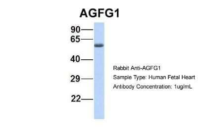 Western Blot: HIV-1 Rev binding protein Antibody [NBP1-57277]