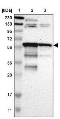 Western Blot: HIV-1 Rev binding protein Antibody [NBP1-91991]