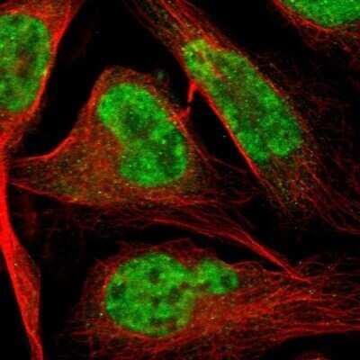 Immunocytochemistry/ Immunofluorescence: HIV-1 Tat specific factor 1 Antibody [NBP1-86966]