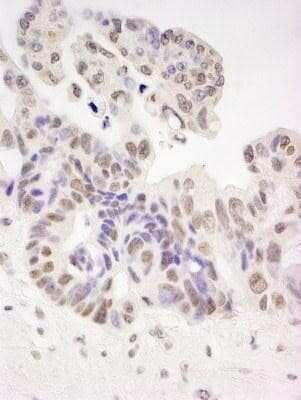 Immunohistochemistry-Paraffin: HIV-1 Tat specific factor 1 Antibody [NBP1-18912]